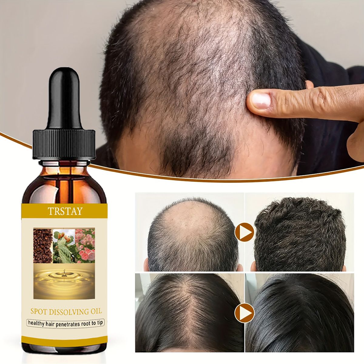 Beard Oil - 50 ml Bartwachstumsöl, Anti-Alopezie, ätherische Öle